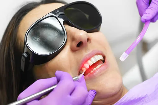 Laser gum shaping